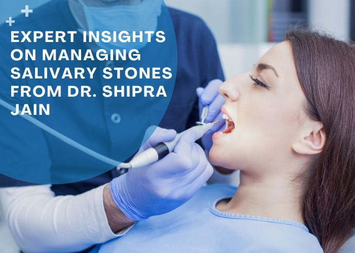 Salivary stones are hardened mineral deposits that form in the salivary glands, leading to various oral health issues. Managing this condition requires expertise.. It is essential to seek professional help for effective management of salivary stones and to ensure optimal oral health.